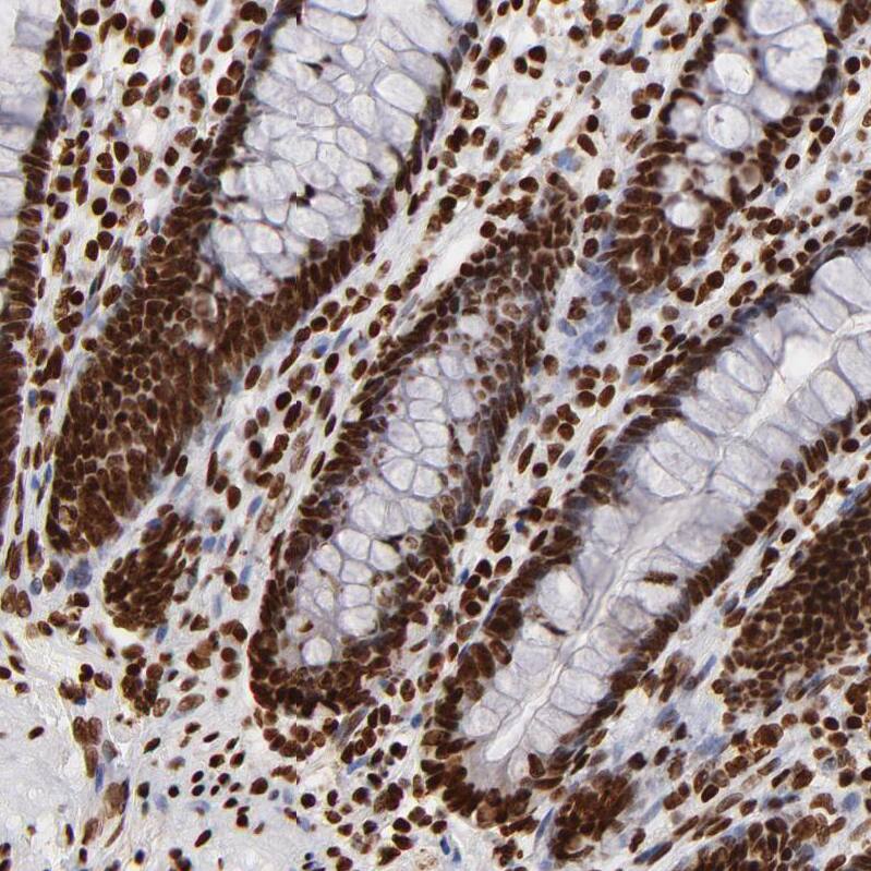 FBXO18 Antibody - BSA Free Immunohistochemistry-Paraffin: FBXO18 Antibody - BSA Free [NBP1-83921]
