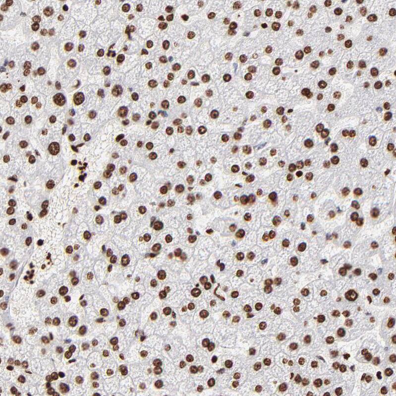 FBXO18 Antibody - BSA Free Immunohistochemistry-Paraffin: FBXO18 Antibody - BSA Free [NBP1-83921]