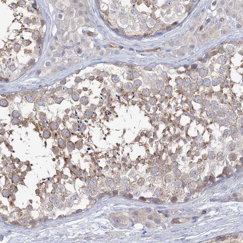 FARSB Antibody - BSA Free Immunohistochemistry-Paraffin: FARSB Antibody - BSA Free [NBP1-83923]