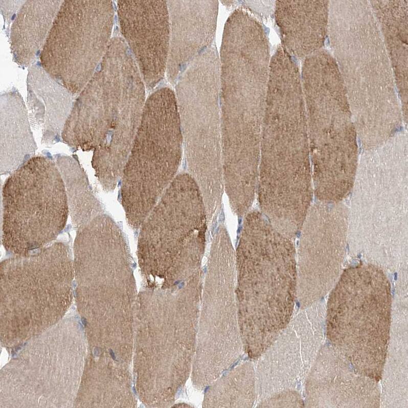 FARSB Antibody - BSA Free Immunohistochemistry-Paraffin: FARSB Antibody - BSA Free [NBP1-83923]