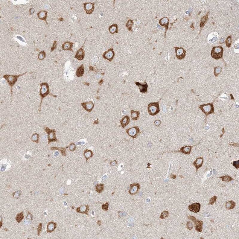 FARSB Antibody - BSA Free Immunohistochemistry-Paraffin: FARSB Antibody - BSA Free [NBP1-83923]