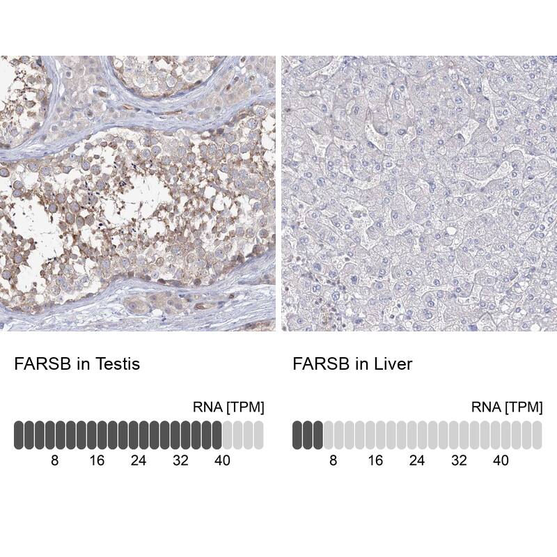 FARSB Antibody - BSA Free Immunohistochemistry-Paraffin: FARSB Antibody - BSA Free [NBP1-83923]