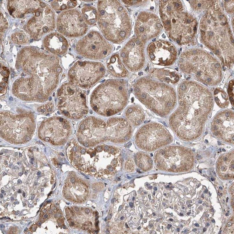 GEMIN8 Antibody - BSA Free Immunohistochemistry-Paraffin: GEMIN8 Antibody - BSA Free [NBP1-83925]