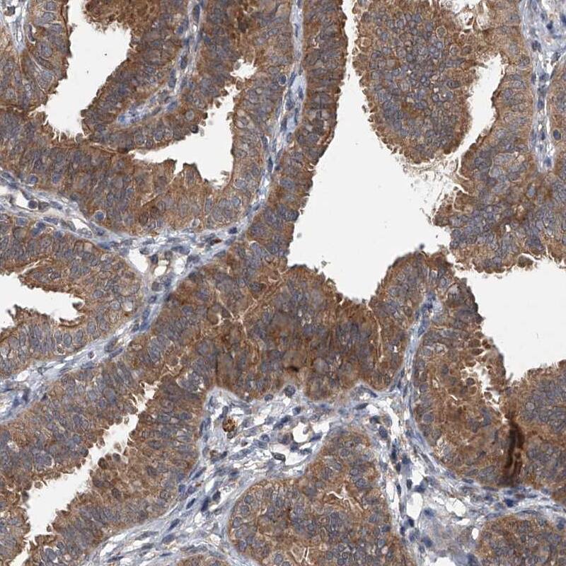 GEMIN8 Antibody - BSA Free Immunohistochemistry-Paraffin: GEMIN8 Antibody - BSA Free [NBP1-83925]