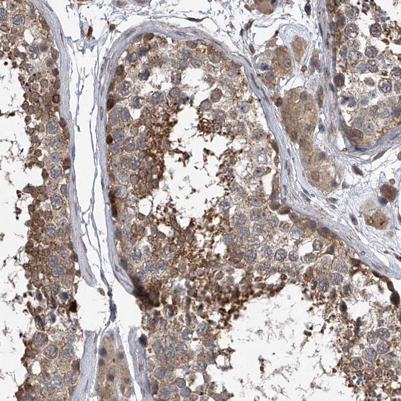 GEMIN8 Antibody - BSA Free Immunohistochemistry-Paraffin: GEMIN8 Antibody - BSA Free [NBP1-83925]