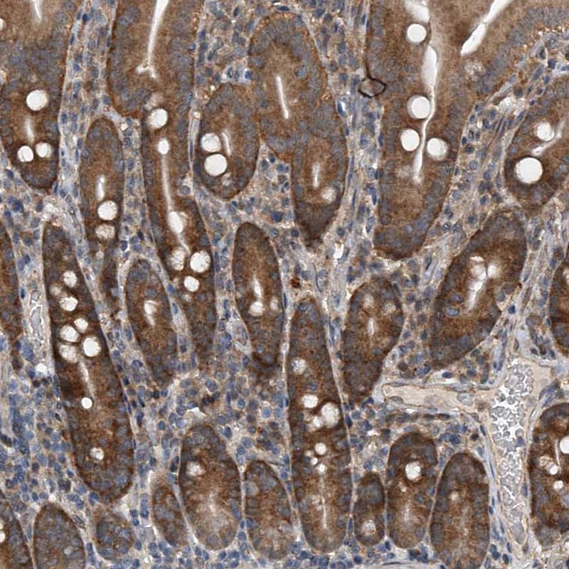 GEMIN8 Antibody - BSA Free Immunohistochemistry-Paraffin: GEMIN8 Antibody - BSA Free [NBP1-83925]
