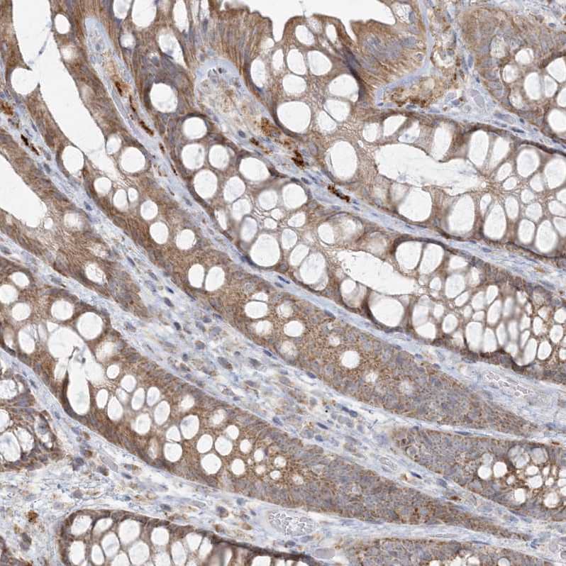 MCAT Antibody - BSA Free Immunohistochemistry-Paraffin: MCAT Antibody - BSA Free [NBP1-83936]