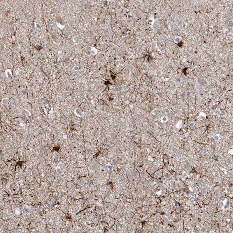 MCAT Antibody - BSA Free Immunohistochemistry-Paraffin: MCAT Antibody - BSA Free [NBP1-83936]