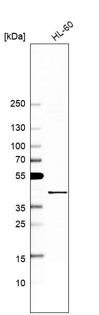MCAT Antibody - BSA Free Western Blot: MCAT Antibody - BSA Free [NBP1-83936]