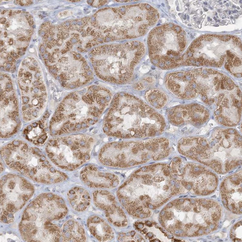 MCAT Antibody - BSA Free Immunohistochemistry-Paraffin: MCAT Antibody - BSA Free [NBP1-83936]