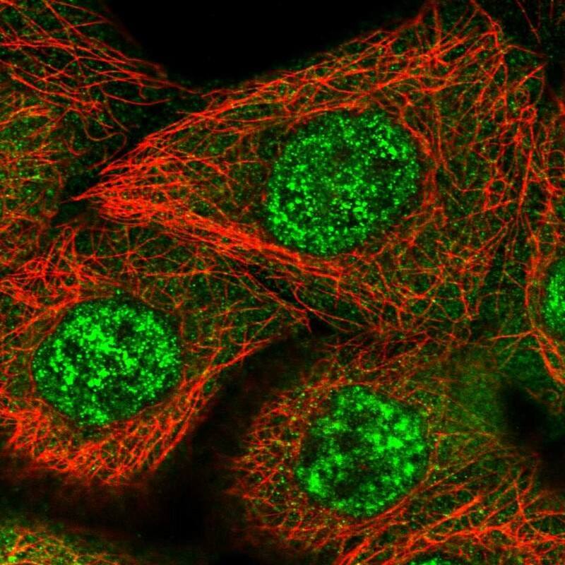 ZNF160 Antibody - BSA Free Immunocytochemistry/ Immunofluorescence: ZNF160 Antibody [NBP1-83939]