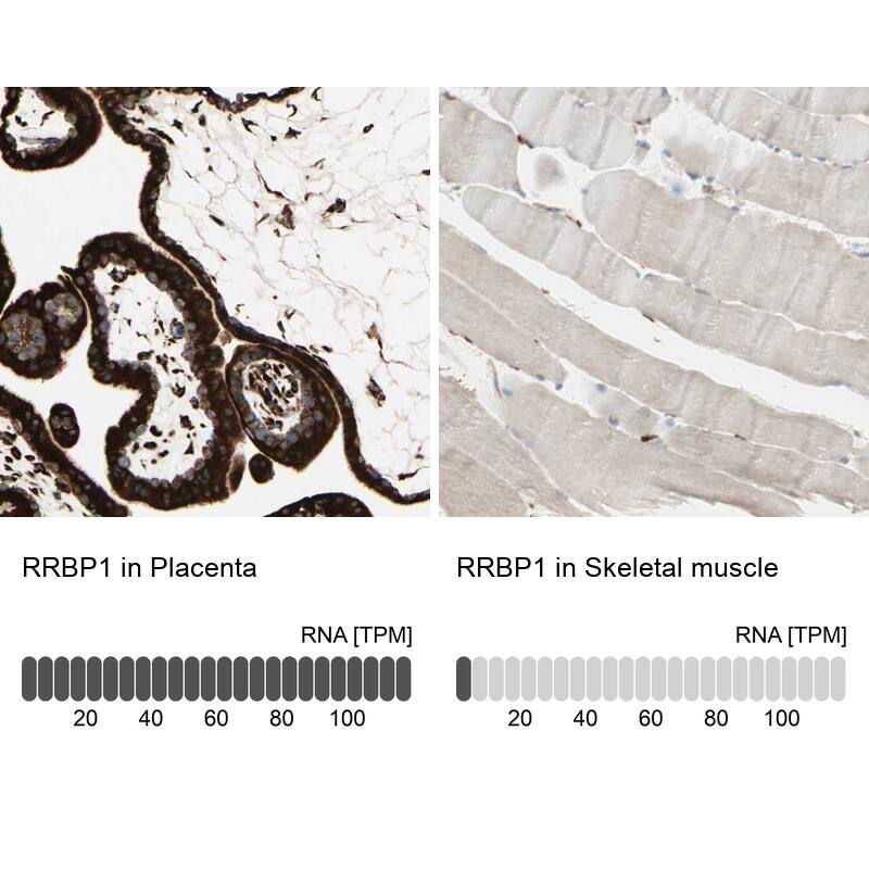 RRBP1 Antibody - BSA Free Immunohistochemistry-Paraffin: RRBP1 Antibody - BSA Free [NBP1-83957]