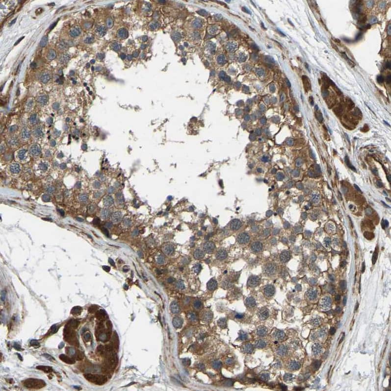 ERGIC1 Antibody - BSA Free Immunohistochemistry-Paraffin: ERGIC1 Antibody - BSA Free [NBP1-83962]