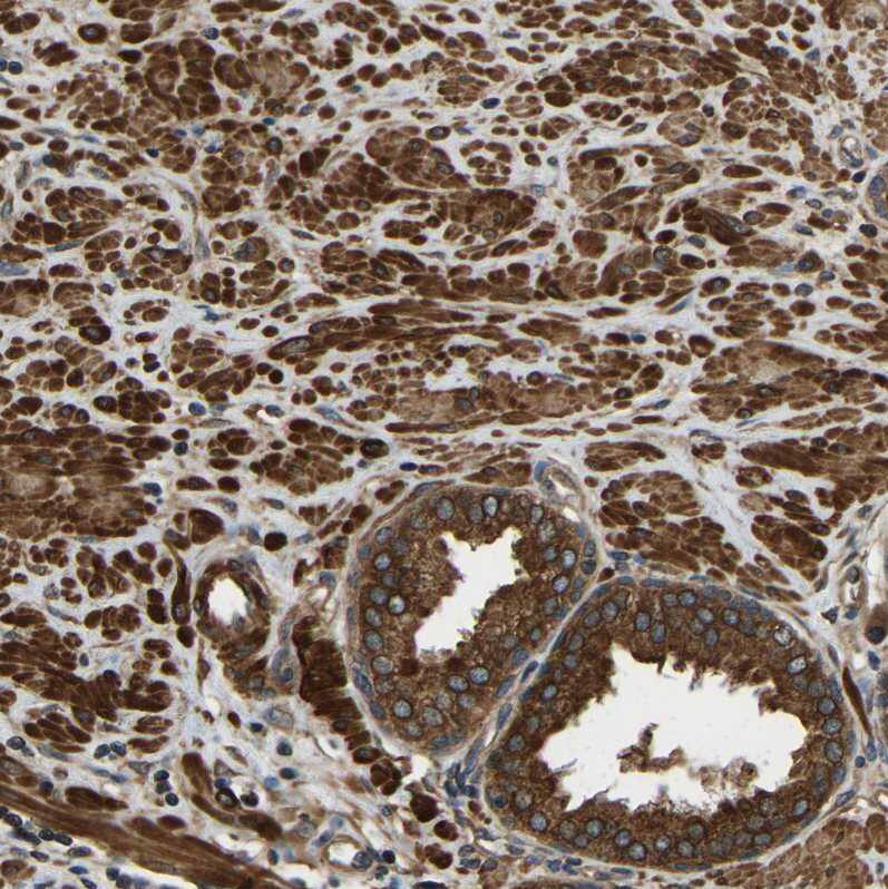 ERGIC1 Antibody - BSA Free Immunohistochemistry-Paraffin: ERGIC1 Antibody - BSA Free [NBP1-83962]