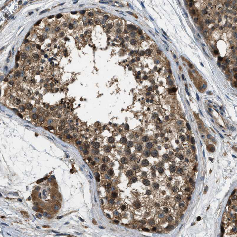 ERGIC1 Antibody - BSA Free Immunohistochemistry-Paraffin: ERGIC1 Antibody - BSA Free [NBP1-83963]