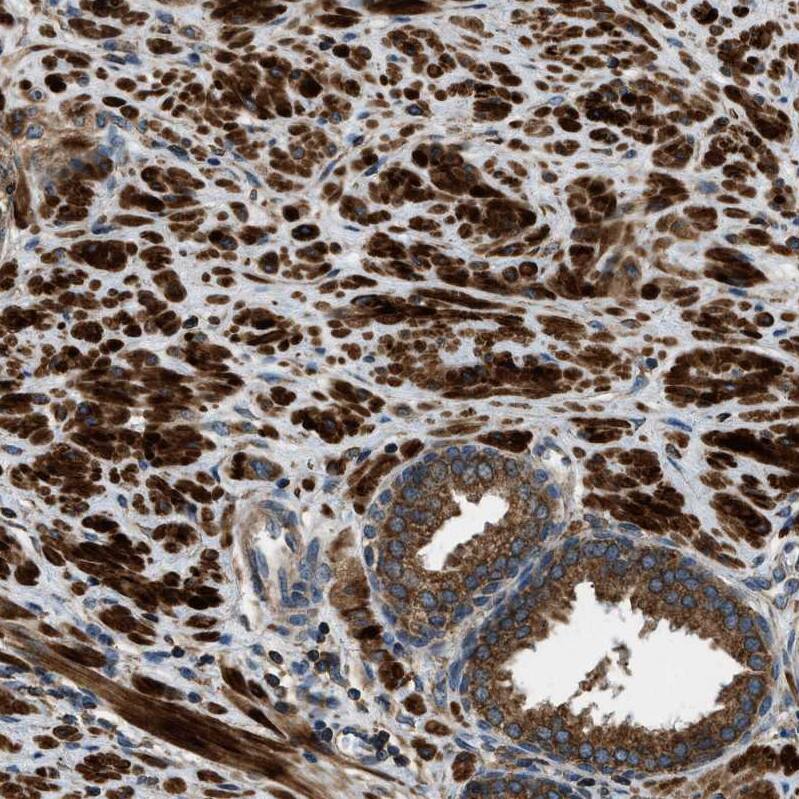 ERGIC1 Antibody - BSA Free Immunohistochemistry-Paraffin: ERGIC1 Antibody - BSA Free [NBP1-83963]