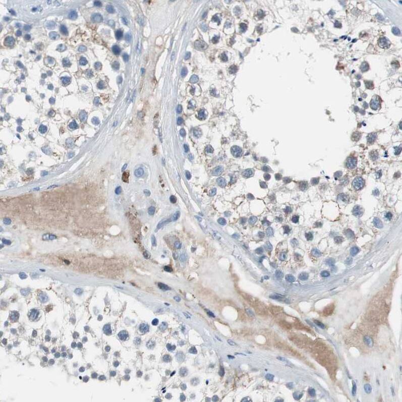 Serpin F1/PEDF Antibody - BSA Free Immunohistochemistry-Paraffin: Serpin F1/PEDF Antibody - BSA Free [NBP1-83972]