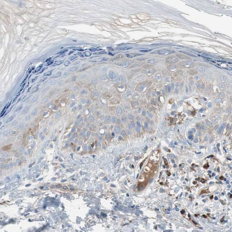 Serpin F1/PEDF Antibody - BSA Free Immunohistochemistry-Paraffin: Serpin F1/PEDF Antibody - BSA Free [NBP1-83972]