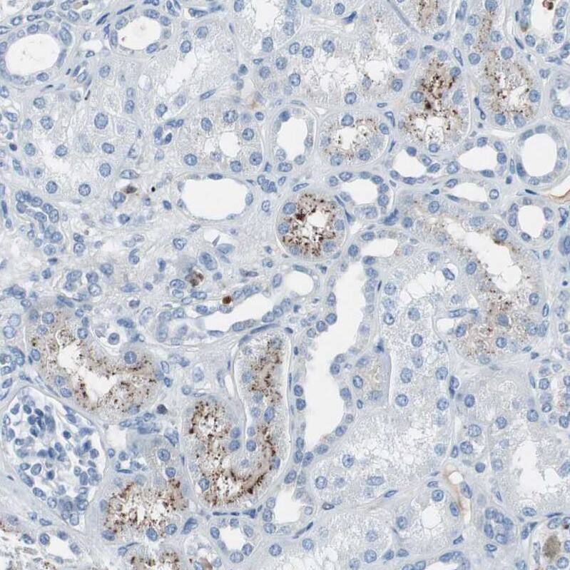 Serpin F1/PEDF Antibody - BSA Free Immunohistochemistry-Paraffin: Serpin F1/PEDF Antibody - BSA Free [NBP1-83972]