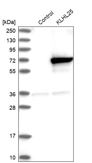 KLHL25 Antibody - BSA Free Western Blot: KLHL25 Antibody - BSA Free [NBP1-83974]
