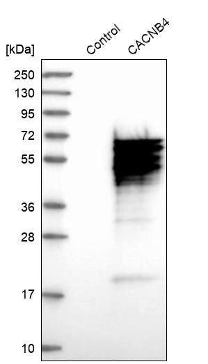 CACNB4 Antibody - BSA Free Western Blot: CACNB4 Antibody - BSA Free [NBP1-83984]