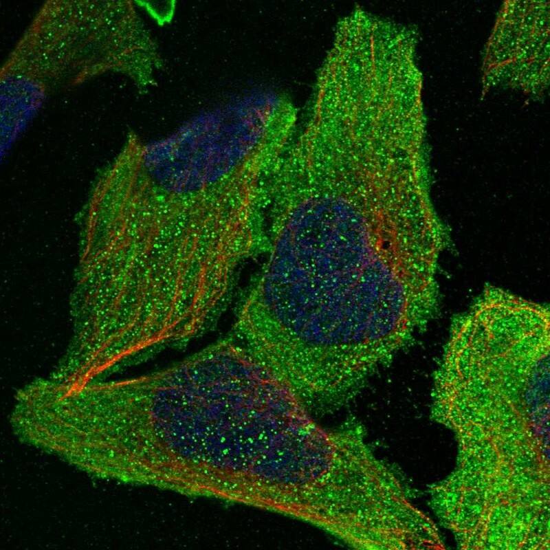 eIF2B3 Antibody - BSA Free Immunocytochemistry/ Immunofluorescence: eIF2B3 Antibody [NBP1-83985]