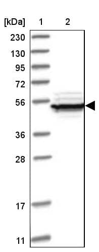 eIF2B3 Antibody - BSA Free Western Blot: eIF2B3 Antibody - BSA Free [NBP1-83985]