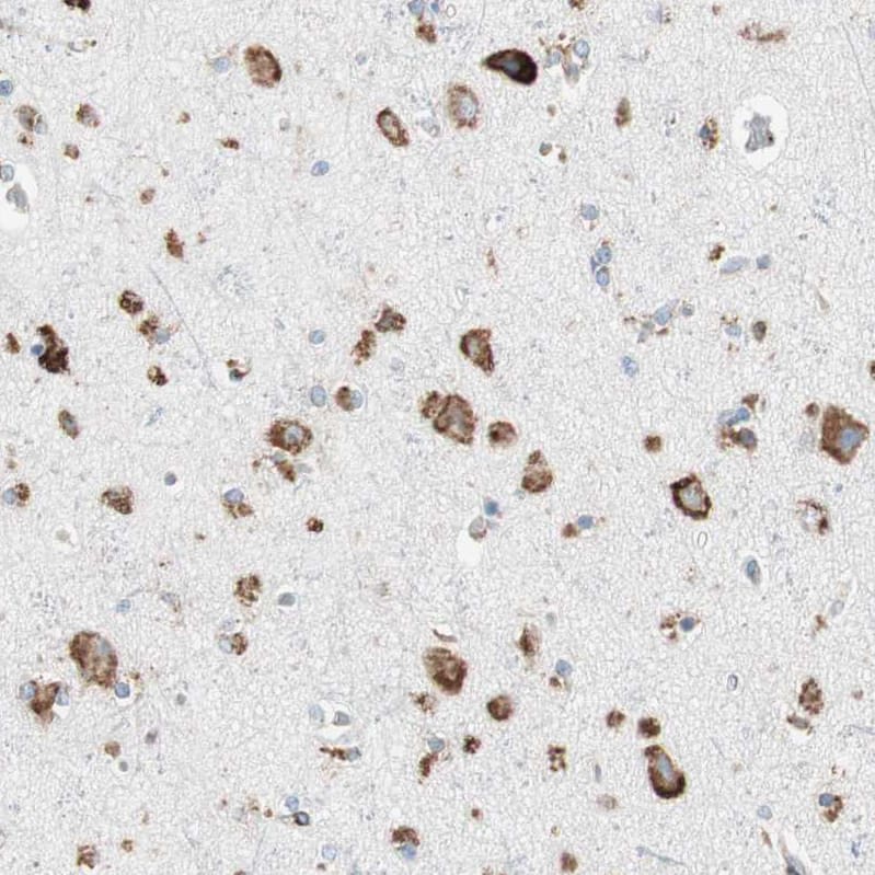 PHD4/HIF Prolyl Hydroxylase 4 Antibody - BSA Free Immunohistochemistry-Paraffin: PHD4/HIF Prolyl Hydroxylase 4 Antibody - BSA Free [NBP1-83989]