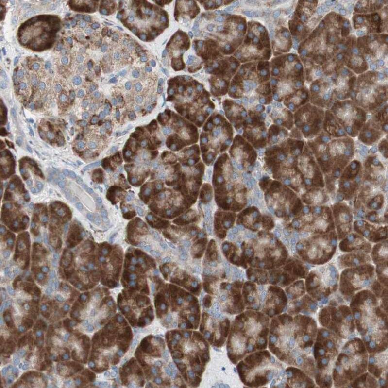 PHD4/HIF Prolyl Hydroxylase 4 Antibody - BSA Free Immunohistochemistry-Paraffin: PHD4/HIF Prolyl Hydroxylase 4 Antibody - BSA Free [NBP1-83989]