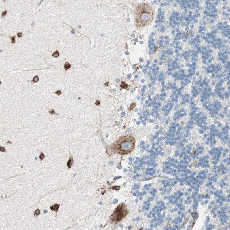 PHD4/HIF Prolyl Hydroxylase 4 Antibody - BSA Free Immunohistochemistry-Paraffin: PHD4/HIF Prolyl Hydroxylase 4 Antibody - BSA Free [NBP1-83989]