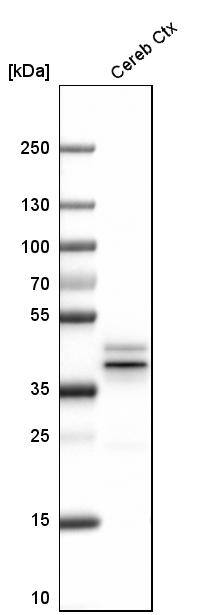 EFCBP2 Antibody - BSA Free Western Blot: EFCBP2 Antibody - BSA Free [NBP1-84002]