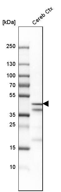 EFCBP2 Antibody - BSA Free Western Blot: EFCBP2 Antibody - BSA Free [NBP1-84002]