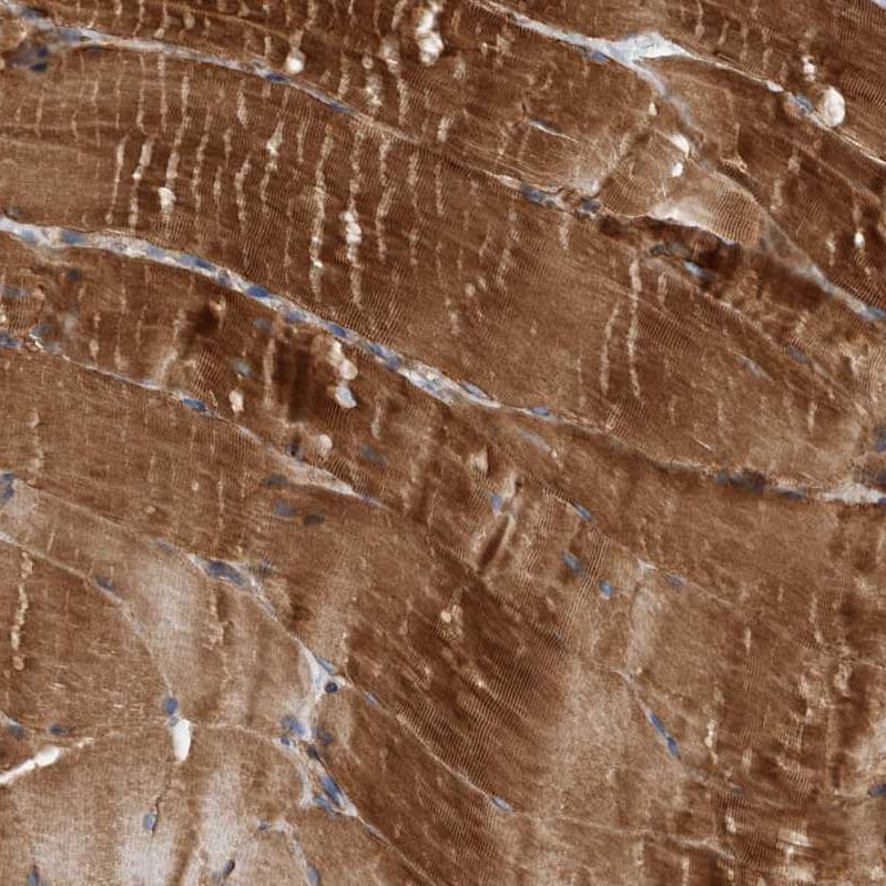 Plectin Antibody - BSA Free Immunohistochemistry-Paraffin: Plectin Antibody - BSA Free [NBP1-84020]