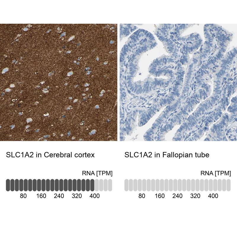 EAAT2/GLT1 Antibody - BSA Free Immunohistochemistry-Paraffin: EAAT2/GLT1 Antibody [NBP1-84027]