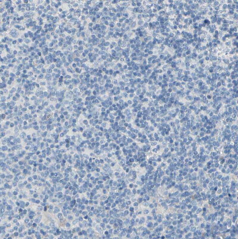 EAAT2/GLT1 Antibody - BSA Free Immunohistochemistry-Paraffin: EAAT2/GLT1 Antibody [NBP1-84027]