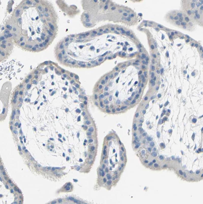 EAAT2/GLT1 Antibody - BSA Free Immunohistochemistry-Paraffin: EAAT2/GLT1 Antibody [NBP1-84027]