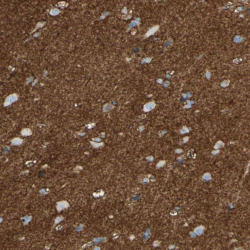 EAAT2/GLT1 Antibody - BSA Free Immunohistochemistry-Paraffin: EAAT2/GLT1 Antibody [NBP1-84027]