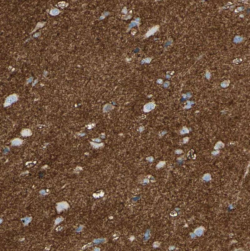 EAAT2/GLT1 Antibody - BSA Free Immunohistochemistry-Paraffin: EAAT2/GLT1 Antibody - BSA Free [NBP1-84027]