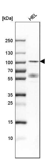 DYRK1A Antibody - BSA Free Western Blot: DYRK1A Antibody - BSA Free [NBP1-84031]