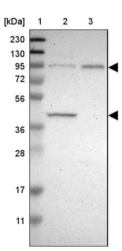 DYRK1A Antibody - BSA Free Western Blot: DYRK1A Antibody - BSA Free [NBP1-84032]