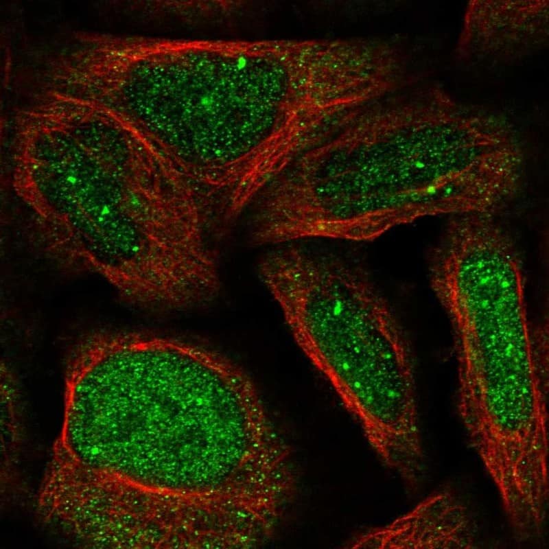 WDR19 Antibody - BSA Free Immunocytochemistry/ Immunofluorescence: WDR19 Antibody [NBP1-84033]