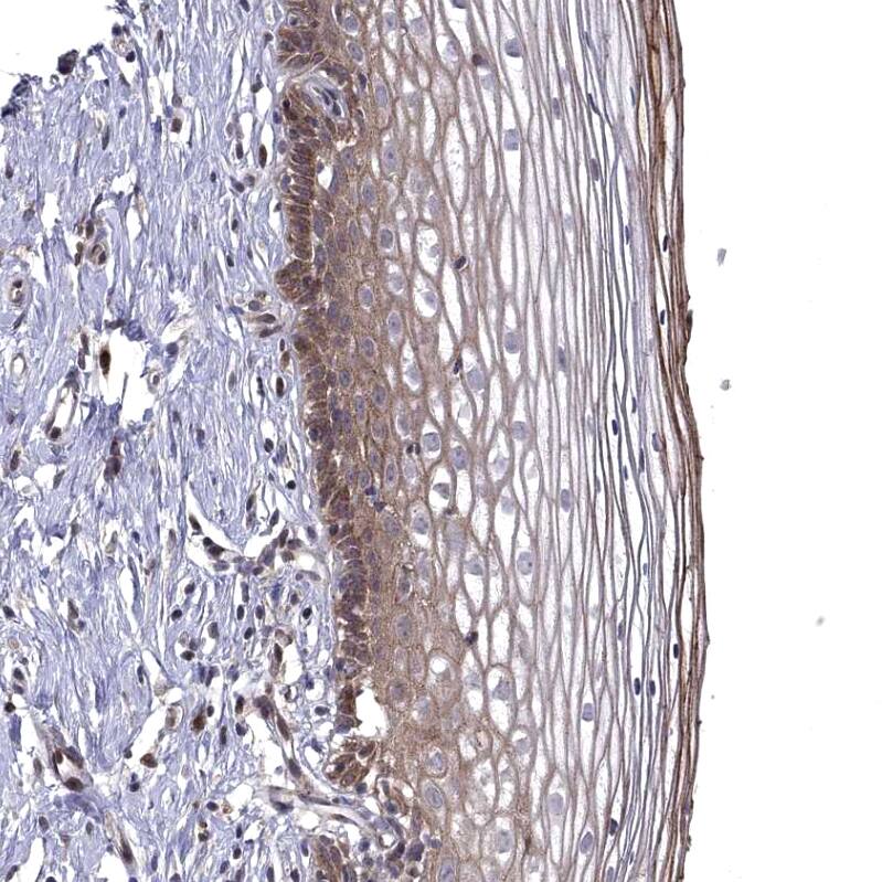 WDR19 Antibody - BSA Free Immunohistochemistry-Paraffin: WDR19 Antibody - BSA Free [NBP1-84033]
