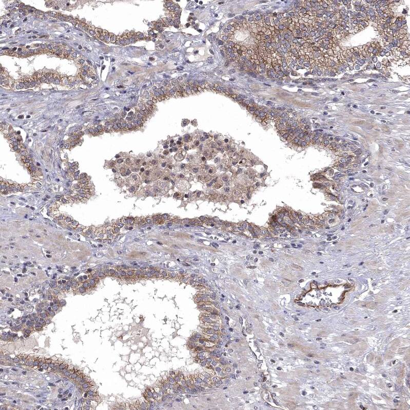 WDR19 Antibody - BSA Free Immunohistochemistry-Paraffin: WDR19 Antibody - BSA Free [NBP1-84033]