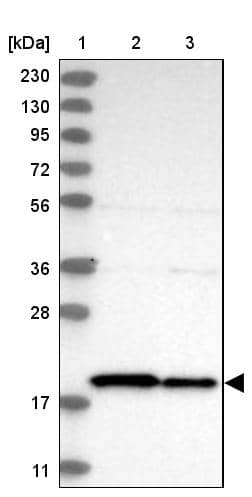 TIMM17B Antibody - BSA Free Western Blot: TIMM17B Antibody - BSA Free [NBP1-84036]