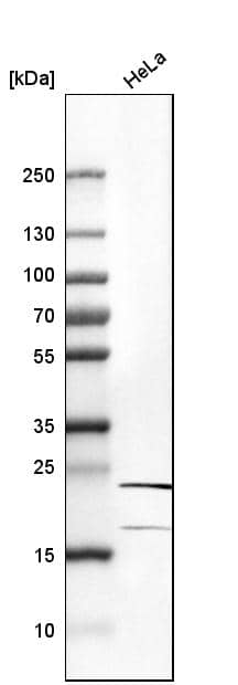 RPL10 Antibody - BSA Free Western Blot: RPL10 Antibody - BSA Free [NBP1-84037]
