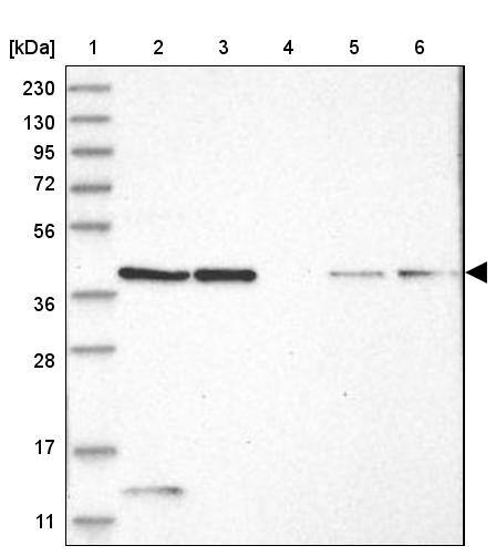 PRUNE Antibody - BSA Free Western Blot: PRUNE Antibody - BSA Free [NBP1-84055]