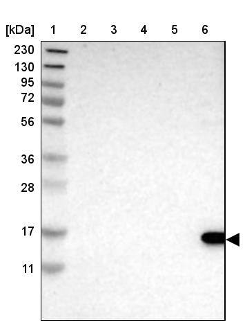TCL1A Antibody Western Blot: BLOC1S1 Antibody [NBP1-86958]