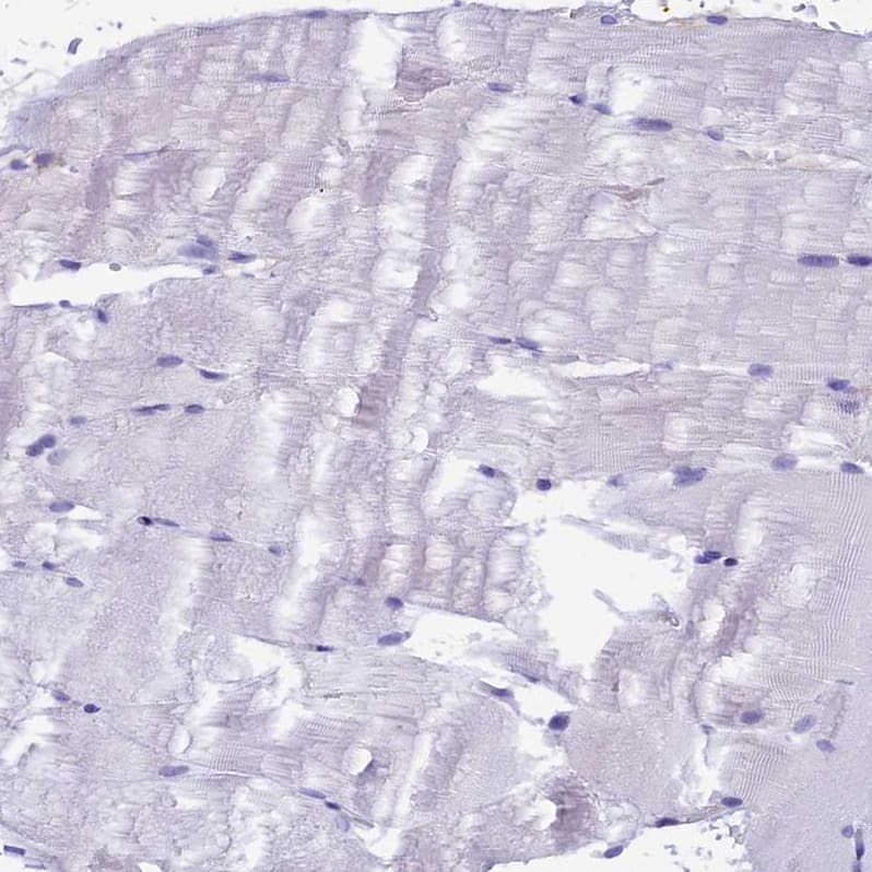 IGSF6/DORA Antibody - BSA Free Immunohistochemistry-Paraffin: IGSF6/DORA Antibody - BSA Free [NBP1-84061]