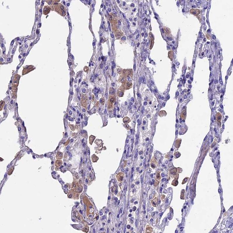 IGSF6/DORA Antibody - BSA Free Immunohistochemistry-Paraffin: IGSF6/DORA Antibody - BSA Free [NBP1-84061]