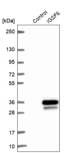 IGSF6/DORA Antibody - BSA Free Western Blot: IGSF6/DORA Antibody - BSA Free [NBP1-84061]